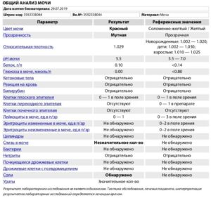 общий анализ мочи (оам)